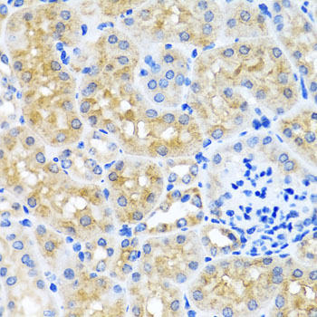 SCO1 Rabbit polyclonal antibody