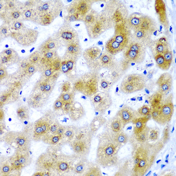 SECISBP2 Rabbit polyclonal antibody