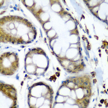 SECISBP2 Rabbit polyclonal antibody