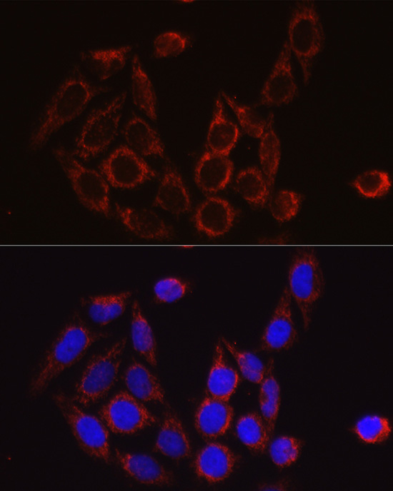 SECISBP2 Rabbit polyclonal antibody