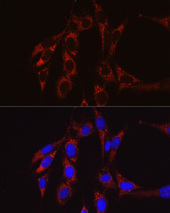 SECISBP2 Rabbit polyclonal antibody