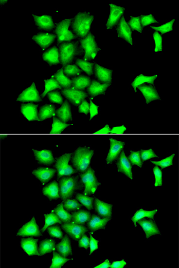 MSRB1 Rabbit polyclonal antibody