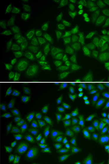 SMPD1 / ASM Rabbit polyclonal antibody