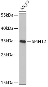 SPINT2 Rabbit polyclonal antibody