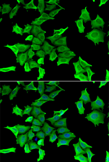 SPINT2 Rabbit polyclonal antibody