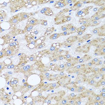 [KO Validated] SRI Rabbit polyclonal antibody
