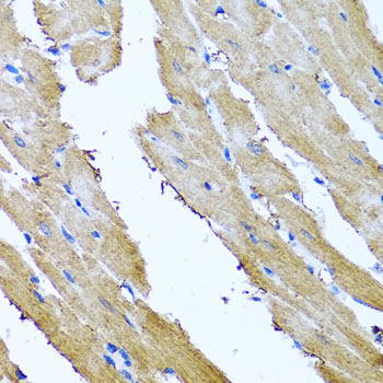 [KO Validated] SRI Rabbit polyclonal antibody