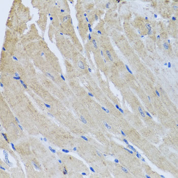 [KO Validated] SRI Rabbit polyclonal antibody