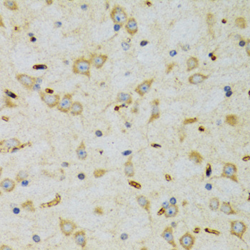 SRP19 Rabbit polyclonal antibody