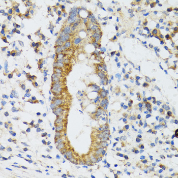 SRP19 Rabbit polyclonal antibody