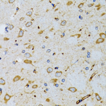 SRP19 Rabbit polyclonal antibody