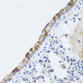 ST3GAL3 Rabbit polyclonal antibody