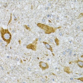 ST3GAL3 Rabbit polyclonal antibody