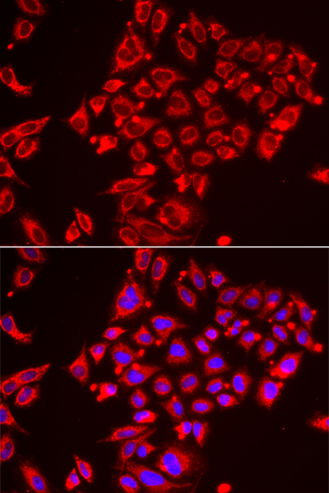 ST3GAL3 Rabbit polyclonal antibody