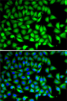 SUFU Rabbit polyclonal antibody