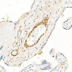 Western blot - Transgelin (TAGLN) Rabbit pAb (A6760)