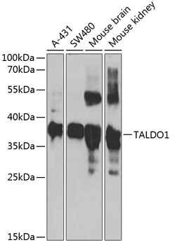 TALDO1 Rabbit polyclonal antibody