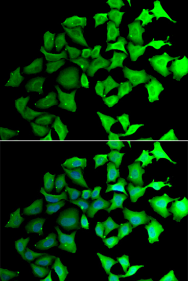 TALDO1 Rabbit polyclonal antibody