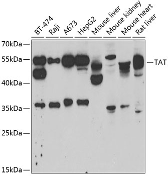 TAT Rabbit polyclonal antibody