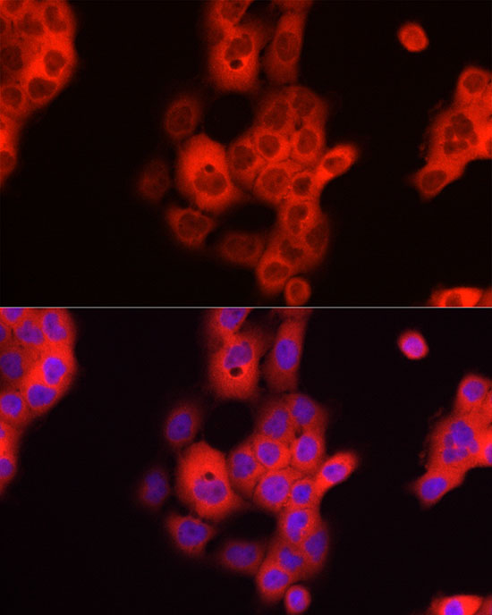 TDO2 Rabbit polyclonal antibody