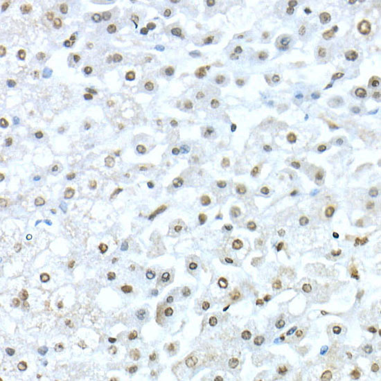 TEAD1 Rabbit polyclonal antibody
