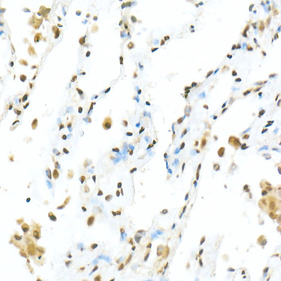 TEAD1 Rabbit polyclonal antibody