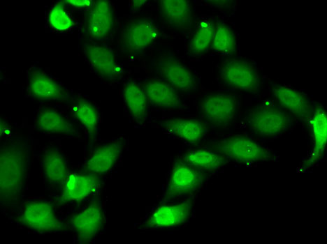 TEAD1 Rabbit polyclonal antibody