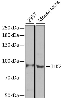 [KO Validated] TLK2 Rabbit polyclonal antibody