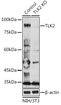 [KO Validated] TLK2 Rabbit polyclonal antibody