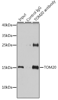 TOM20 Rabbit polyclonal antibody