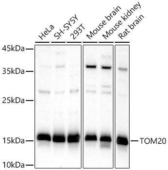 TOM20 Rabbit polyclonal antibody