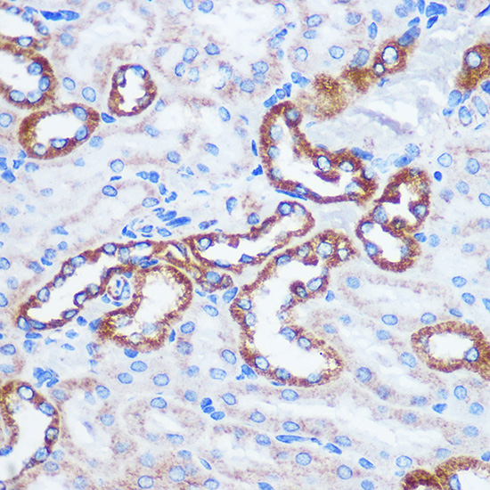 TOM20 Rabbit polyclonal antibody