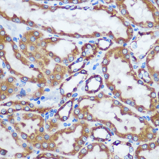 TOM20 Rabbit polyclonal antibody