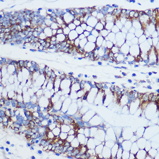 TOM20 Rabbit polyclonal antibody