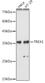 TREX1 Rabbit polyclonal antibody