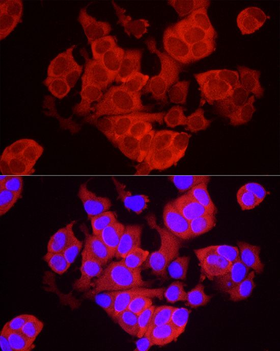 TREX1 Rabbit polyclonal antibody