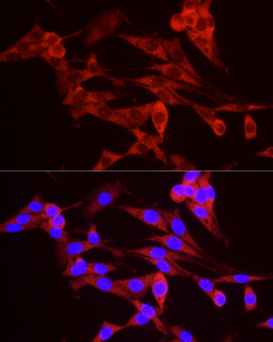 TREX1 Rabbit polyclonal antibody