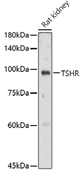 TSHR Rabbit polyclonal antibody