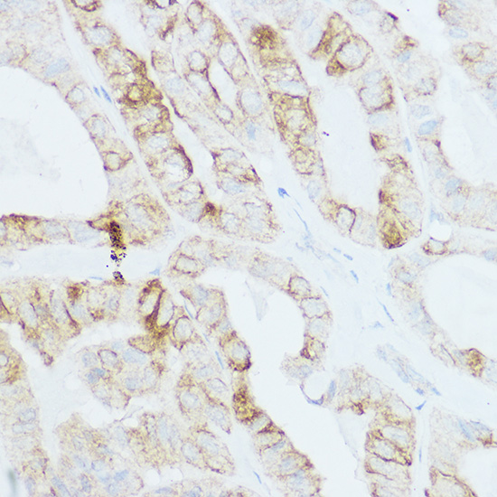 TSHR Rabbit polyclonal antibody