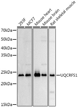 UQCRFS1 Rabbit polyclonal antibody
