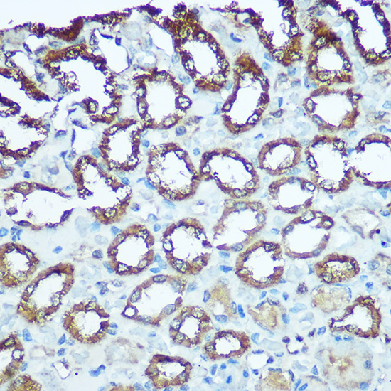 UQCRFS1 Rabbit polyclonal antibody