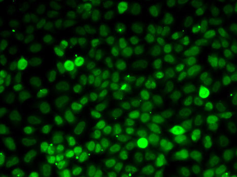 Exportin 5 (XPO5) Rabbit polyclonal antibody