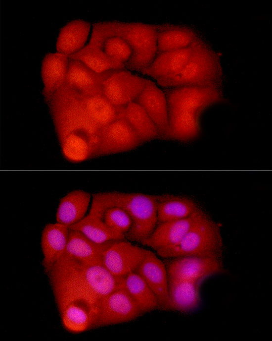 Exportin 5 (XPO5) Rabbit polyclonal antibody