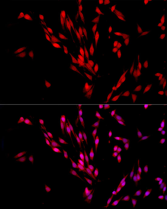 Exportin 5 (XPO5) Rabbit polyclonal antibody