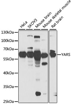 Western blot analysis of various lysates using YARS Rabbit pAb (A6791) at 1:1000 dilution.<br/>Secondary antibody: HRP-conjugated Goat anti-Rabbit IgG (H+L) (AS014) at 1:10000 dilution.<br/>Lysates/proteins: 25μg per lane.<br/>Blocking buffer: 3% nonfat dry milk in TBST.<br/>Detection: ECL Basic Kit (RM00020).<br/>Exposure time: 30s.