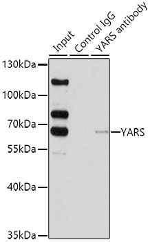 YARS Rabbit polyclonal antibody