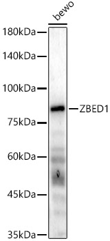 ZBED1 Rabbit polyclonal antibody