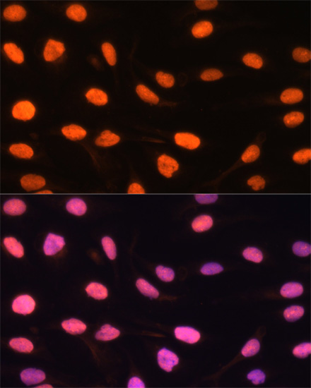 ZBED1 Rabbit polyclonal antibody