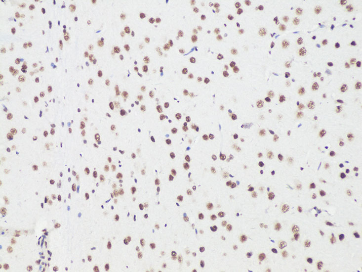Bcl9 Rabbit polyclonal antibody
