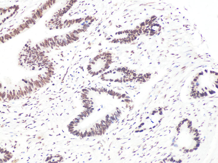Bcl9 Rabbit polyclonal antibody